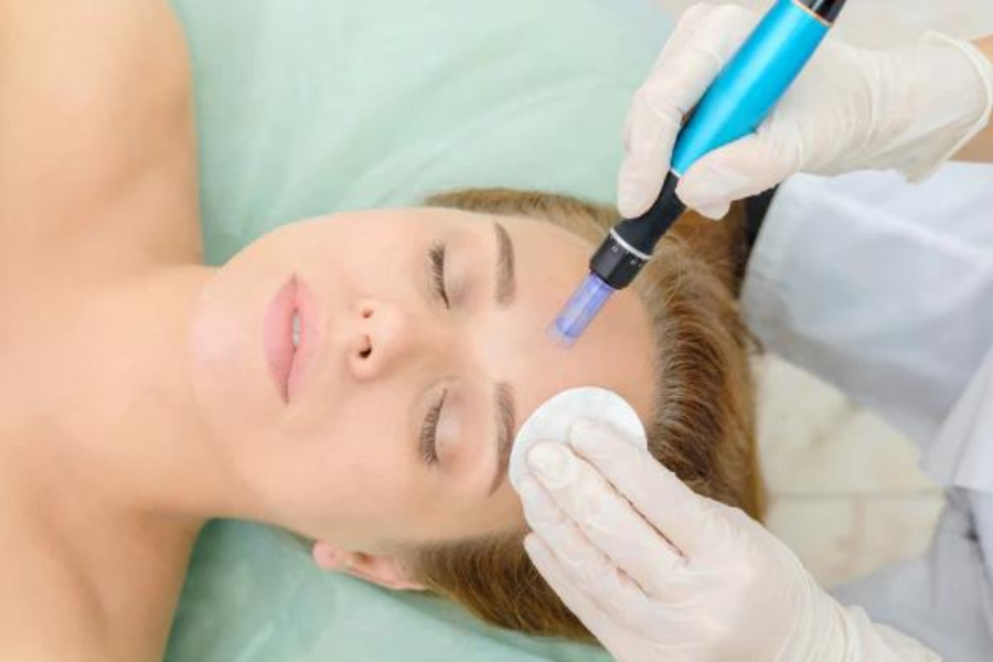  Woman laying down having her forehead microneedled with the Dr Pen A1-W microneedling pen