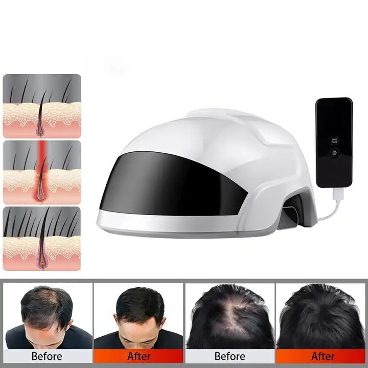 VolumePro Hair Growth Helmet 46 Laser Diodes 60 LED